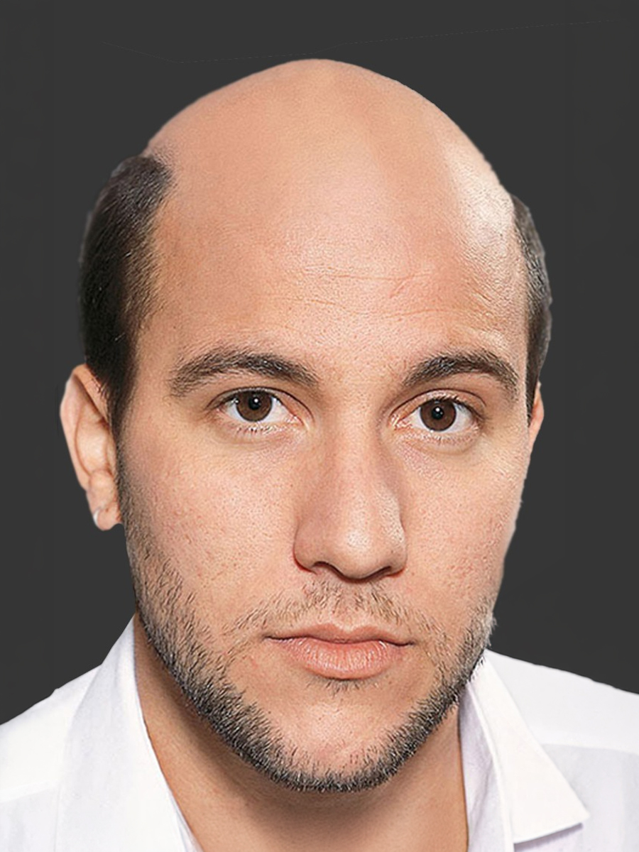 Öncesi