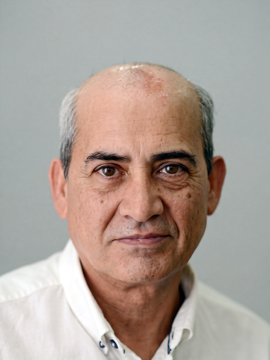 Öncesi