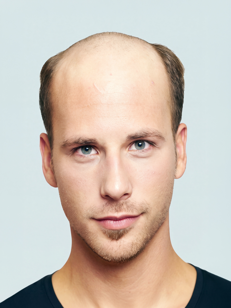 Öncesi