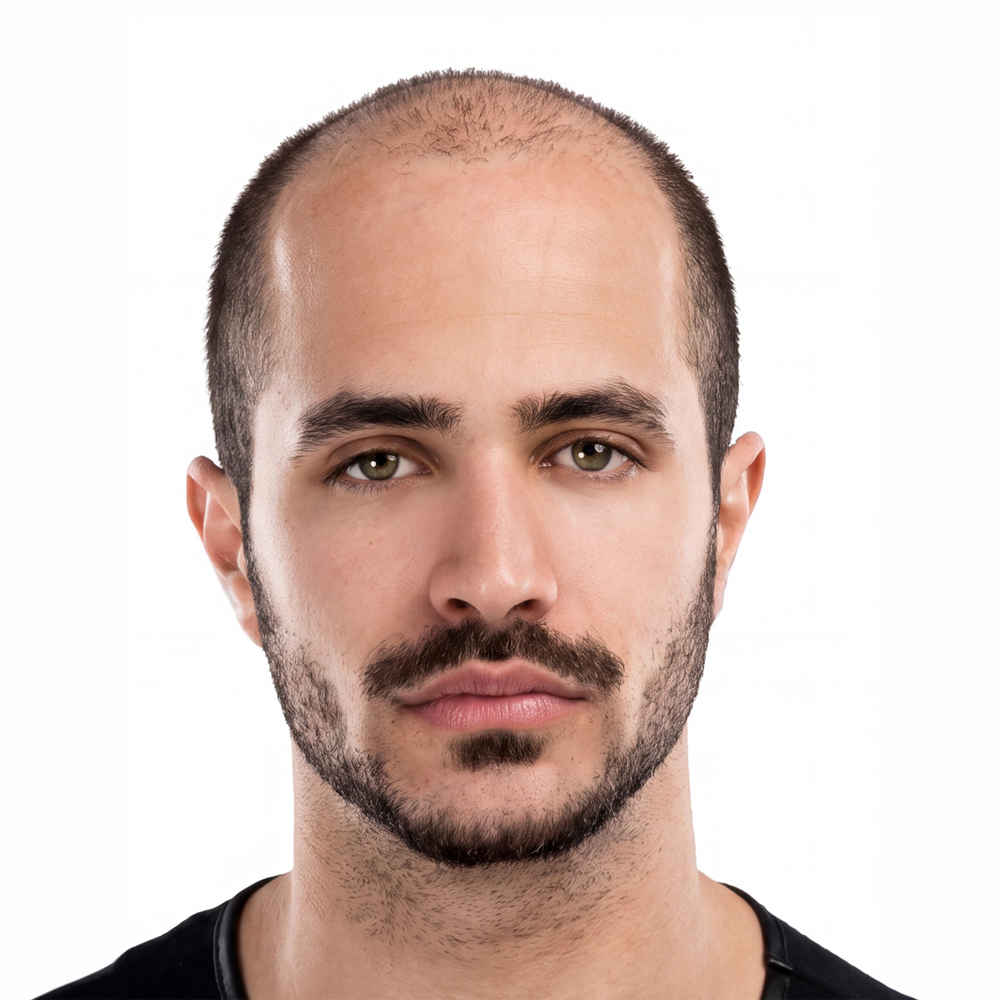 Protez Saç Uygulama Öncesi